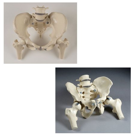 Anatomical Model, Male & Female Pelvis Set w/Femur Heads -  DENOYER-GEPPERT, SV623